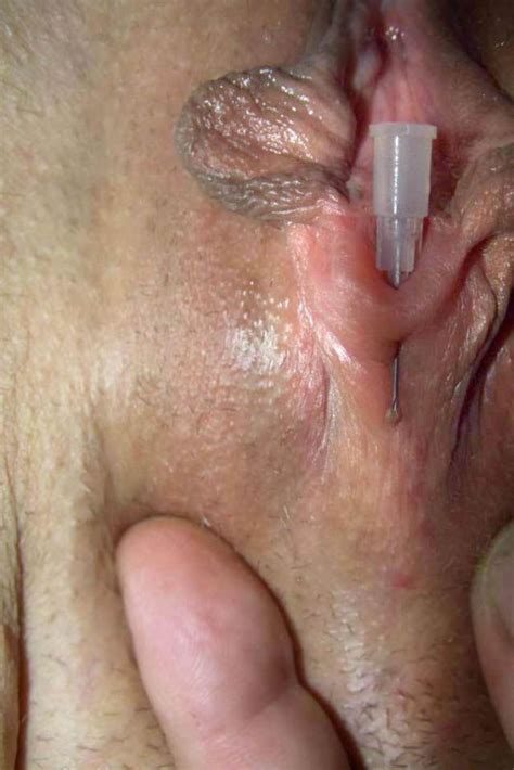 Penis Injection Torture Sexdicted