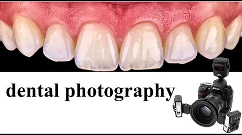 Dental Photography Youtube