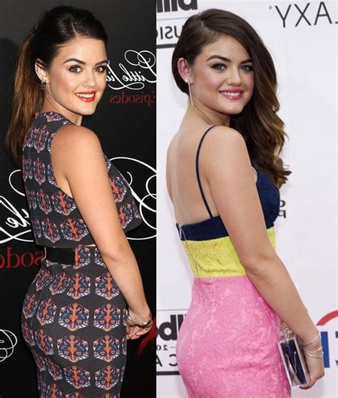 Lucy Hale Plastic Surgery Plastic Surgery Lucy Hale Facial Fillers