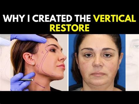 New Face Facelift Revolutionaries Vertical Restoration It Works Wonder Development Tips