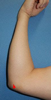 Viimeisimmät twiitit käyttäjältä ケイン・ヤリスギ「♂」 (@kein_yarisugi). 手の外科外傷センター 対応疾患 ｜ 特定医療法人 誠仁会 大久保 ...