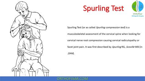 Spurling Test • Easy Explain 2024