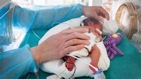 Survival Rates Among Extremely Preterm Infants Keep Improving Medpage