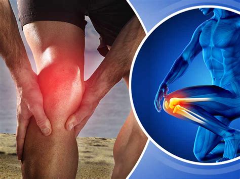 Knee Pain What Are The Causes Of The Knee Pain Lifealth