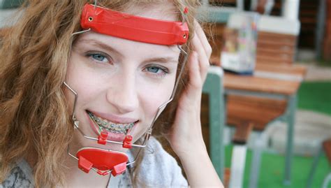 Heres How Headgear Can Improve Your Childs Smile 20 Mile Orthodontics