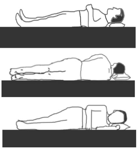 Procedures that call for supine positioning, on the other hand, are hampered by higher shunt flow to the nondependent lung and may have higher rates of. Sleeping position included supine, right lateral decubitus ...
