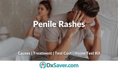 Penile Rashes Causes Std Symptoms In Men Treatment And Testing Cost