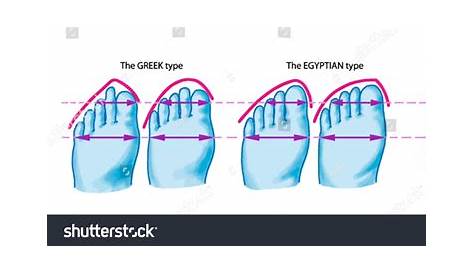 Three Types Foot Shape Greek Egyptian Stock Vector 135303368 - Shutterstock
