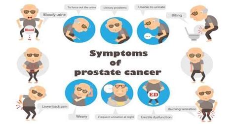 Prostate Cancer Symptoms Signs