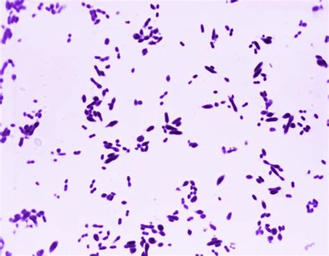 Gram Positive Streptococci