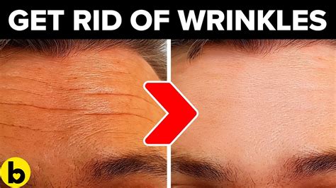 14 Ways To Get Rid Of Wrinkles On Your Forehead Naturally Youtube