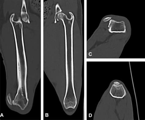 Full Article Patellar Luxation In Dogs