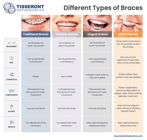 What Types Of Braces Are There You Should Know This