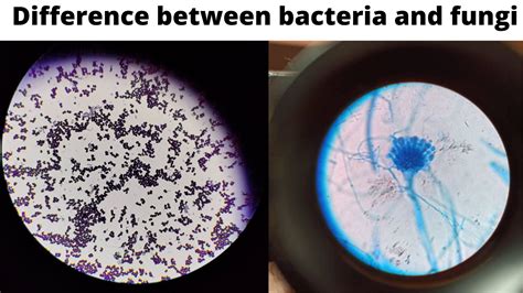 Differences And Similarities Between Bacteria And Fungi • Microbe Online