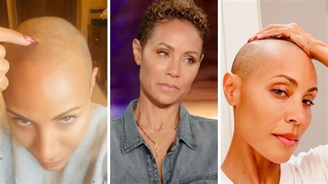 Jada Pinkett Smith Reveals Battle With Alopecia