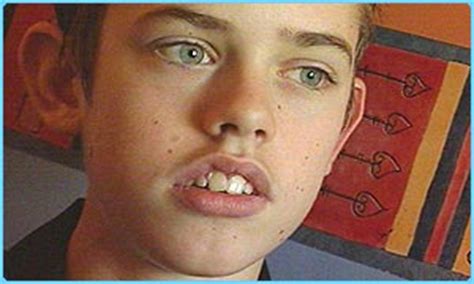 Asperger syndrome diagnosis in children. autism speaks: Asperger Sendromu