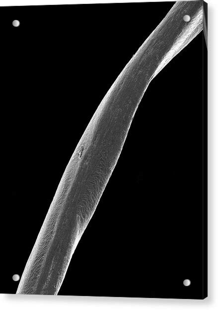 Human Pubic Hair Photograph By Dennis Kunkel Microscopyscience Photo
