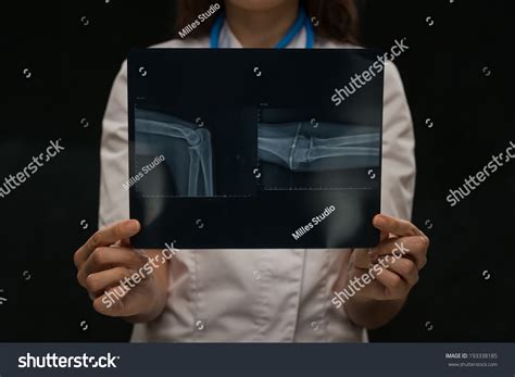 Doctor Examining Arm Bones Radiography Stock Photo 193338185 Shutterstock