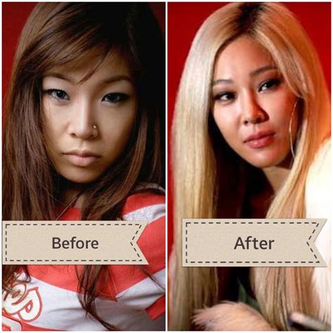 kpop plastic surgery before and after hot sex picture