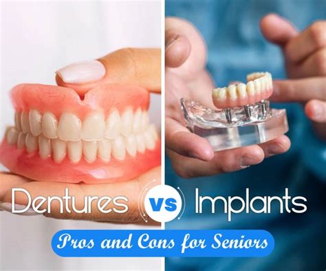 Dentures Vs Implants Pros And Cons For Seniors Bbn Community