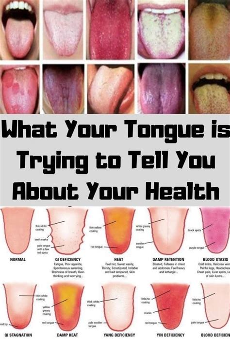 What Your Tongue Is Trying To Tell You About Your Health In 2020 Healthy Tongue Tongue Health