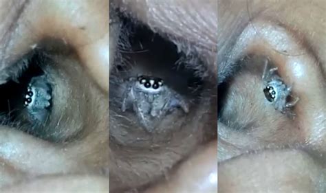 Spider Crawls Out Of Indian Womans Ear Watch Terrifying Video Of