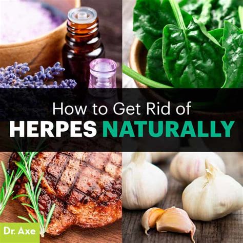 how to get rid of herpes symptoms naturally dr axe