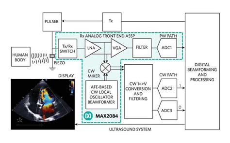 Ultrasound Imaging Gets High Performance Design Ee Times Asia