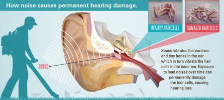 Noise Induced Hearing Loss Hearing Loss Association Of America