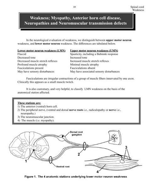 Are Fasciculations Upper Or Lower Motor Neuron