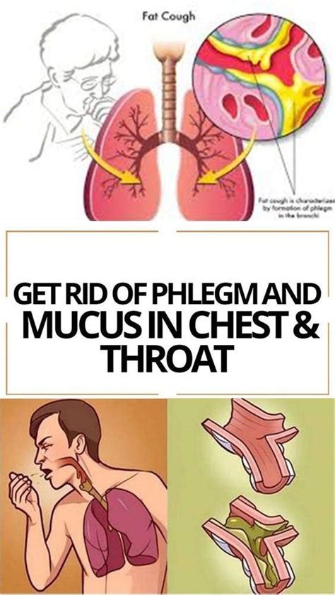 7 Natural Remedies To Flush Mucus From Your Body Getting Rid Of Phlegm Chest Congestion