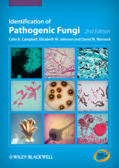 National Collection Of Pathogenic Fungi Launches Newsletter