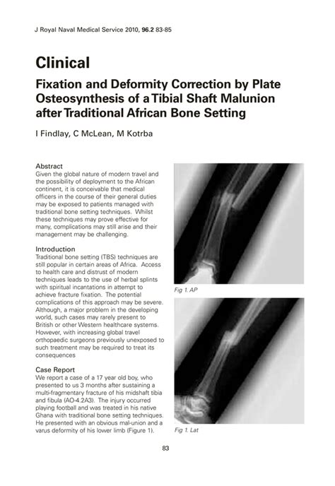 Fixation And Deformity Correction By Plate Osteosynthesis Of A Tibial