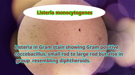 Listeria monocytogenes is the species of pathogenic bacteria that causes the infection listeriosis. Listeria monocytogenes under microscope - YouTube