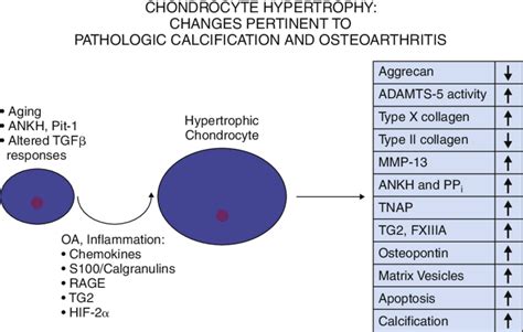 factors that promote chondrocyte hypertrophy in articular cartilage and download scientific