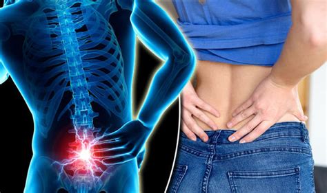 Back Pain Causes Symptoms Diagnosis