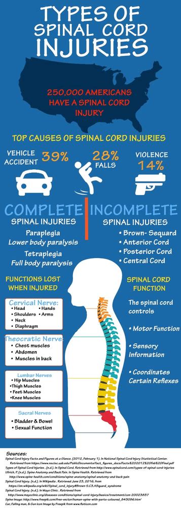 Types Of Spinal Cord Injuries Infographic