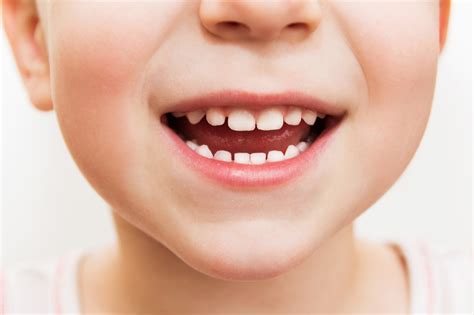 If your child has cavities, the bacteria in his or her mouth are imbalanced. What Causes Tooth Decay in Children | Children Dental Care