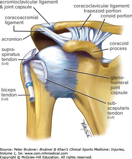 Acromioclavicular Joint Sprains And Common Problems