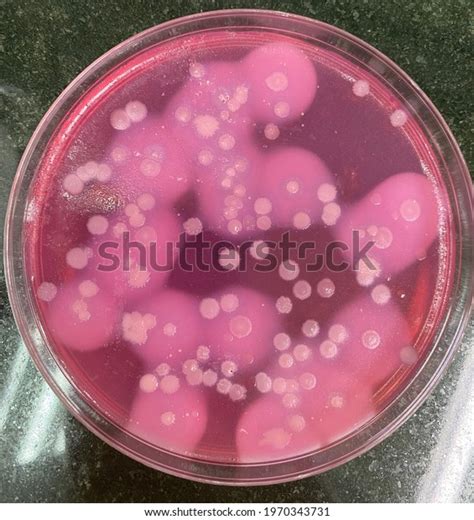 Typical Bacillus Cereus Pink Colonies Surrounded Stock Photo 1970343731