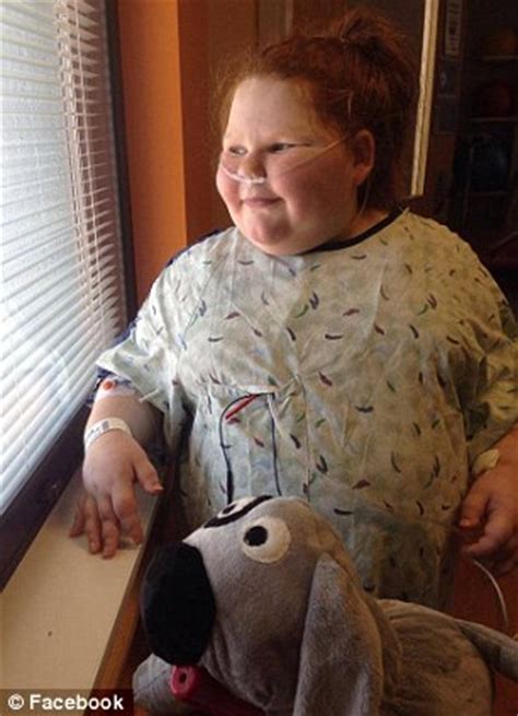 Texas Year Old With Metabolic Disorder Lost Lbs After Gastric