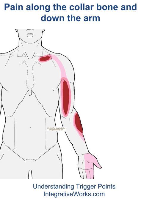 Pin On Hand Trigger Point Pain