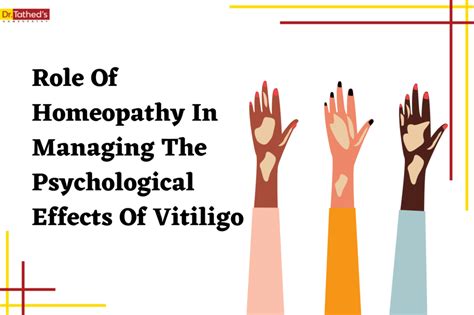 The Role Of Homeopathy In Managing The Psychological Effects Of