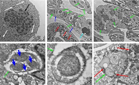 Transmission Electron Microscopy Images Showing Autophagic Compartments Download Scientific