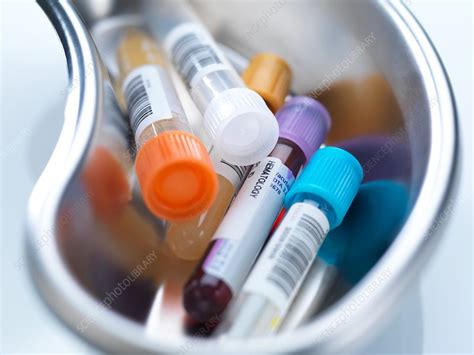 Medical Samples Stock Image F0175563 Science Photo Library