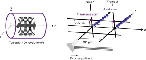 Physical Principles And Equipment Of Intravascular Optical Coherence