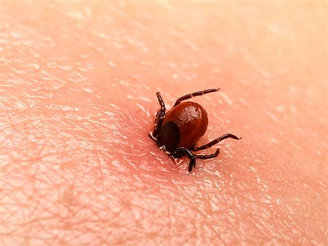 Are You Ticked Off This Years Lyme Disease Is A Doozy Cbn