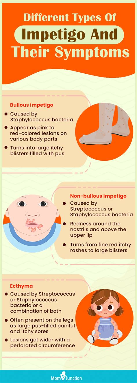 Different Types Of Impetigo And Their Symptoms Infographic