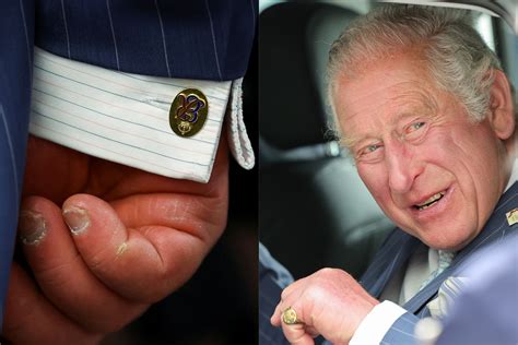 Prince Charles Hands Go Viral After Photos Of Swollen Fingers