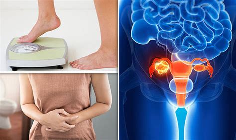 Cancer Symptoms Ovarian Signs Of Tumour Revealed Including Weight Loss